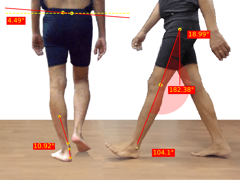 A detailed visualization of gait analysis showing body angles and biomechanics during walking, highlighting the precise measurement of movement patterns for health and rehabilitation purposes.